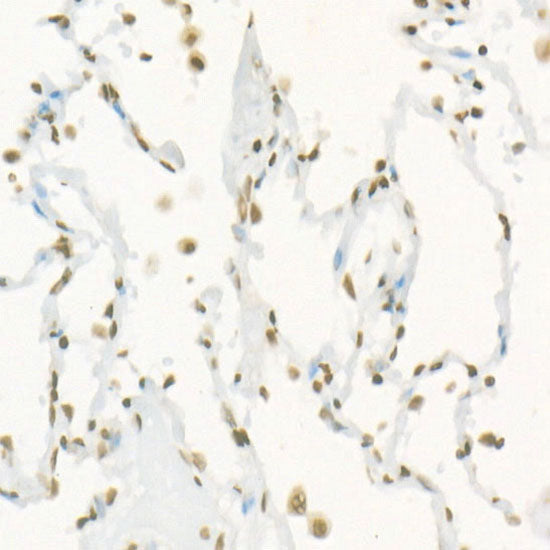 Symmetric DiMethyl-Histone H3-R17 Rabbit mAb