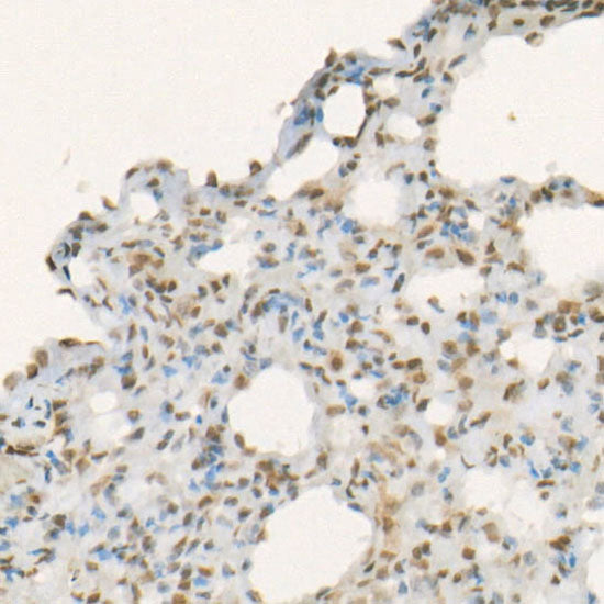 Symmetric DiMethyl-Histone H3-R17 Rabbit mAb