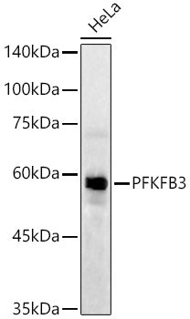PFKFB3 Rabbit mAb