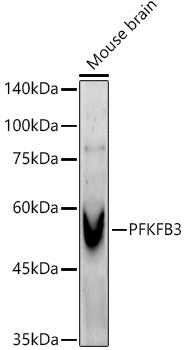 PFKFB3 Rabbit mAb