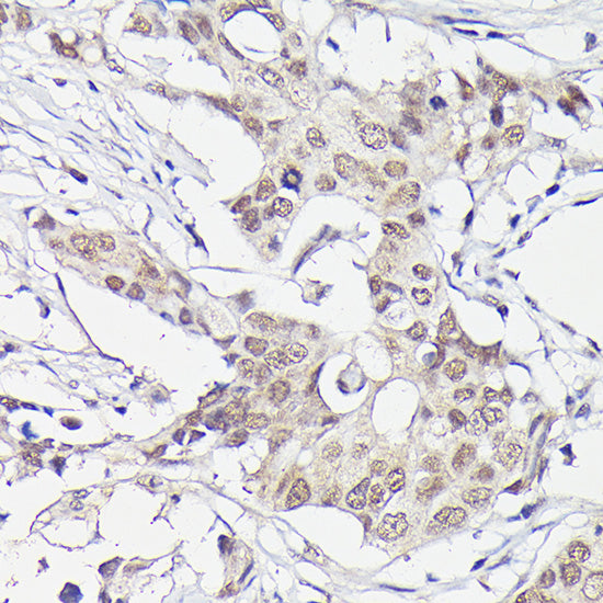 PFKFB3 Rabbit mAb