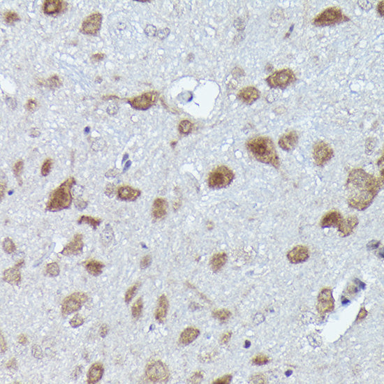 PFKFB3 Rabbit mAb