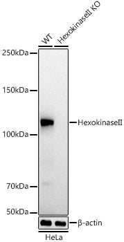 [KO Validated] Hexokinase II Rabbit mAb