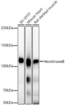 [KO Validated] Hexokinase II Rabbit mAb