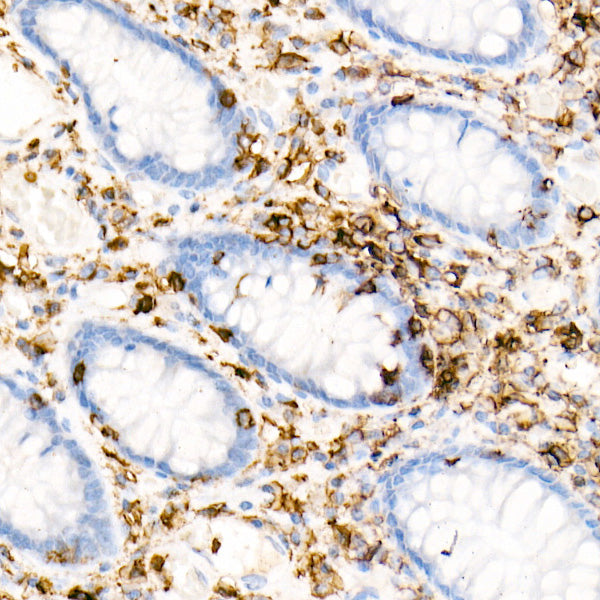 CD45 Rabbit mAb