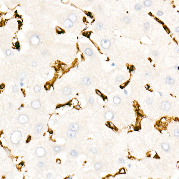 CD45 Rabbit mAb