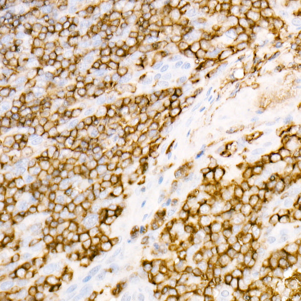 CD45 Rabbit mAb
