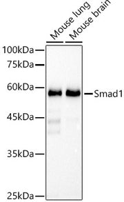 [KO Validated] Smad1 Rabbit mAb