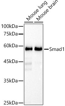 [KO Validated] Smad1 Rabbit mAb