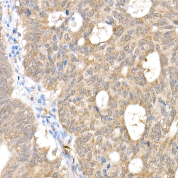 [KO Validated] Smad1 Rabbit mAb