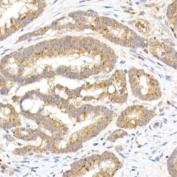 MMP3 Rabbit mAb