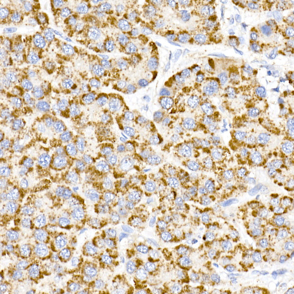 MMP3 Rabbit mAb
