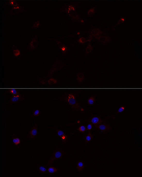 MMP3 Rabbit mAb