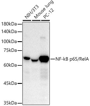 [KO Validated] NF-kB p65/RelA Rabbit mAb