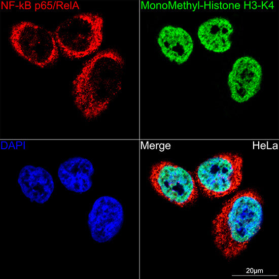 [KO Validated] NF-kB p65/RelA Rabbit mAb