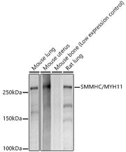 SMMHC/MYH11 Rabbit mAb