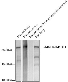 SMMHC/MYH11 Rabbit mAb