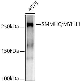 SMMHC/MYH11 Rabbit mAb