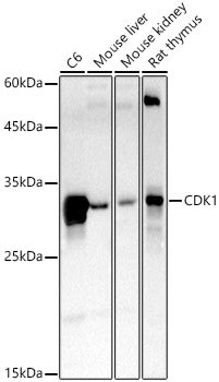 CDK1 Rabbit mAb