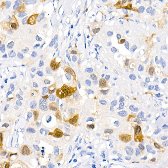 CDK1 Rabbit mAb