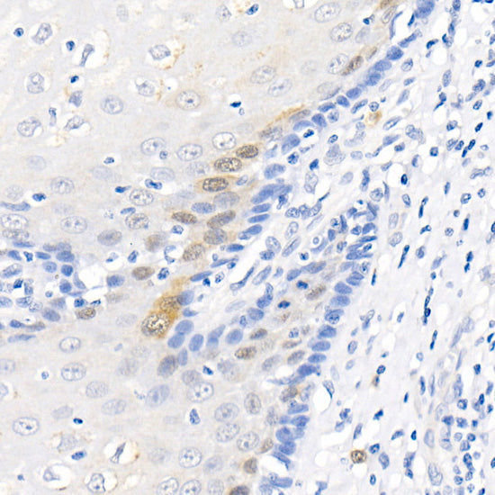 CDK1 Rabbit mAb