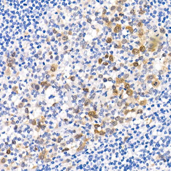 CDK1 Rabbit mAb
