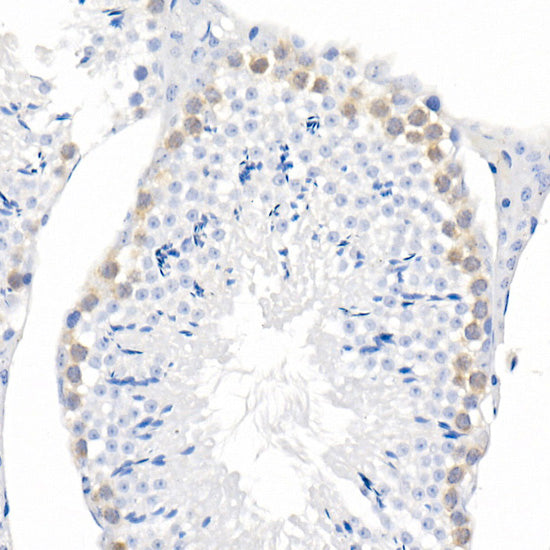 CDK1 Rabbit mAb