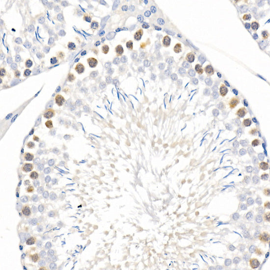 CDK1 Rabbit mAb