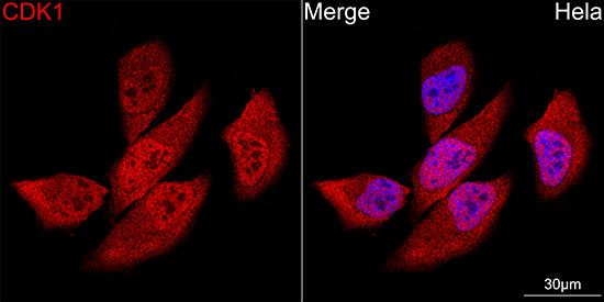 CDK1 Rabbit mAb