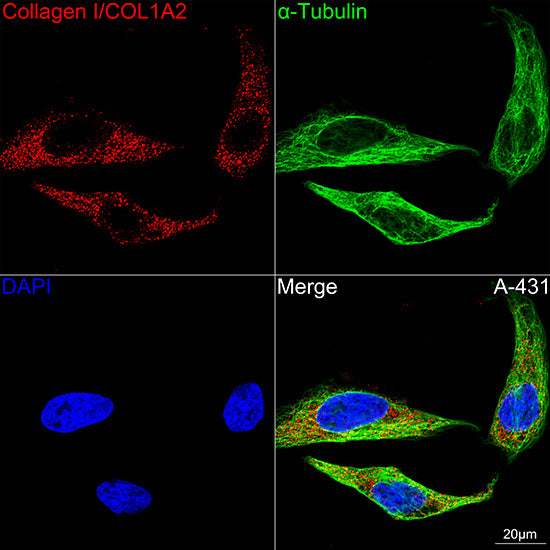 Collagen I/COL1A2 Rabbit mAb