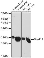 SNAP25 Rabbit mAb