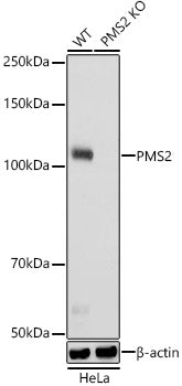 [KO Validated] PMS2 Rabbit mAb
