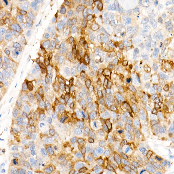 ALDH1A1 Rabbit mAb