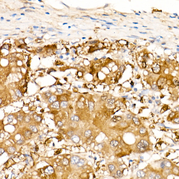 ALDH1A1 Rabbit mAb