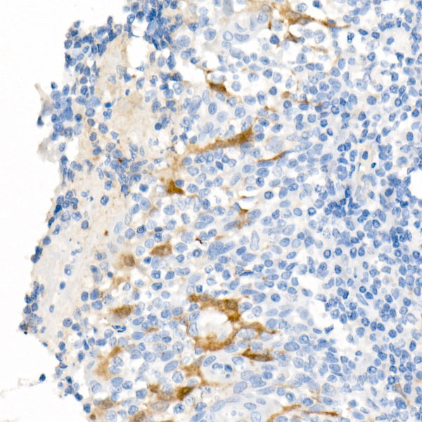ALDH1A1 Rabbit mAb