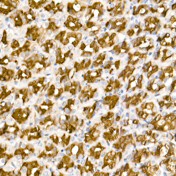 ALDH1A1 Rabbit mAb