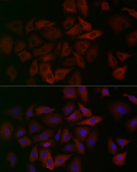 ALDH1A1 Rabbit mAb