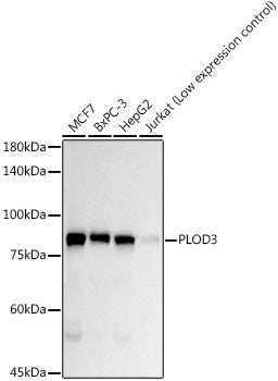 PLOD3 Rabbit mAb