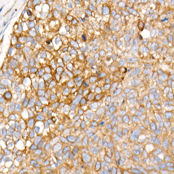 PLOD3 Rabbit mAb