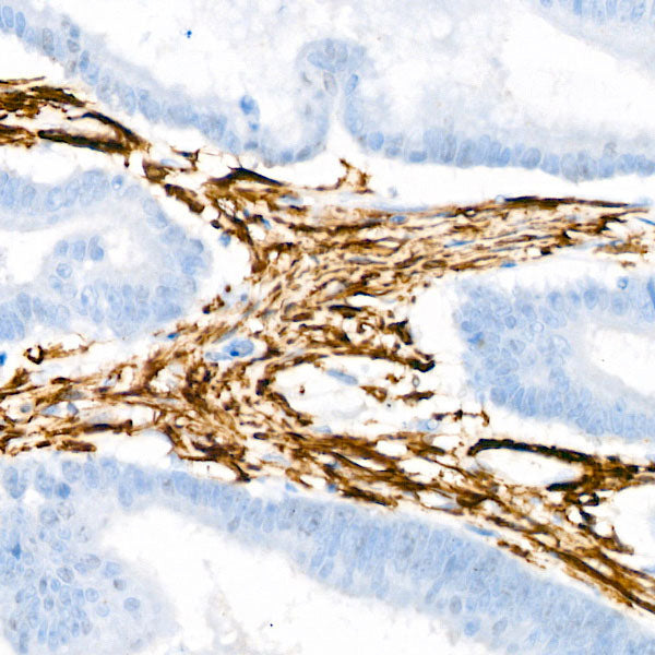 α-Actin-1 (α-SMA) Rabbit mAb