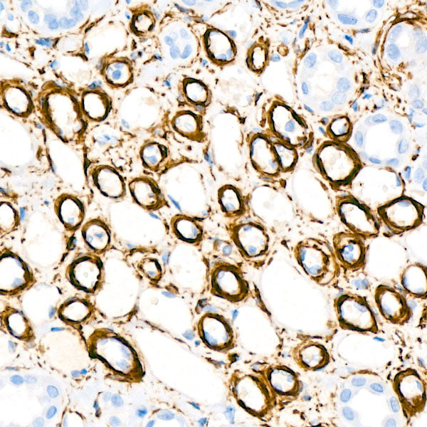 α-Actin-1 (α-SMA) Rabbit mAb