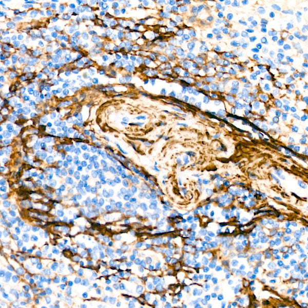 α-Actin-1 (α-SMA) Rabbit mAb