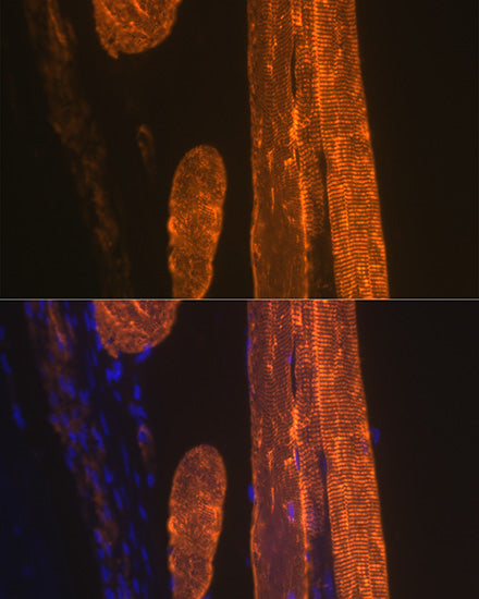 α-Actin-1 (α-SMA) Rabbit mAb