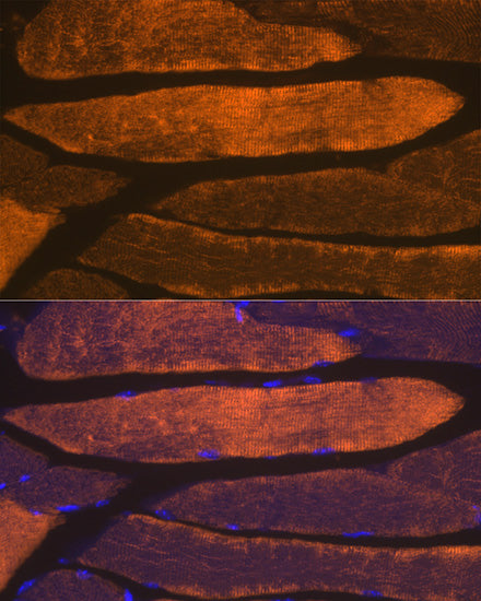 α-Actin-1 (α-SMA) Rabbit mAb