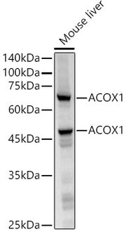 ACOX1 Rabbit mAb