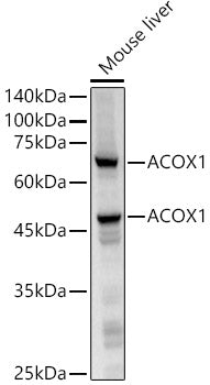 ACOX1 Rabbit mAb