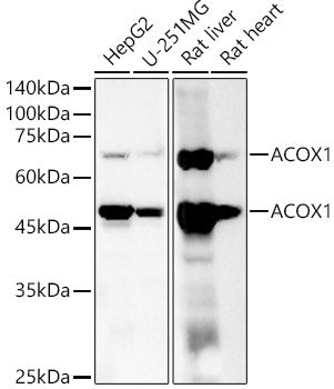 ACOX1 Rabbit mAb