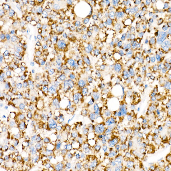 ACOX1 Rabbit mAb
