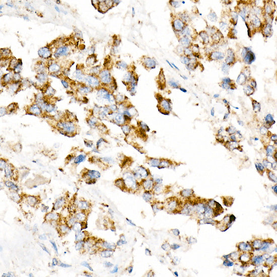 ACOX1 Rabbit mAb