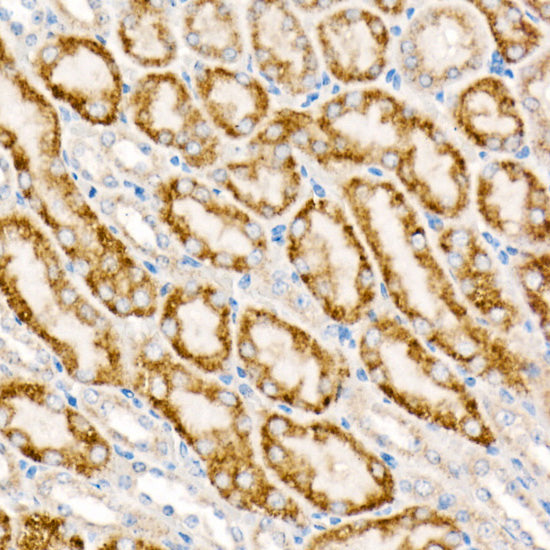 ACOX1 Rabbit mAb
